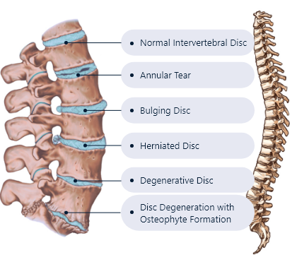 Examples of Disc Problems