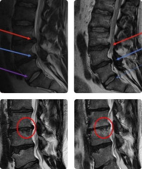 Imaging and Diagnostics