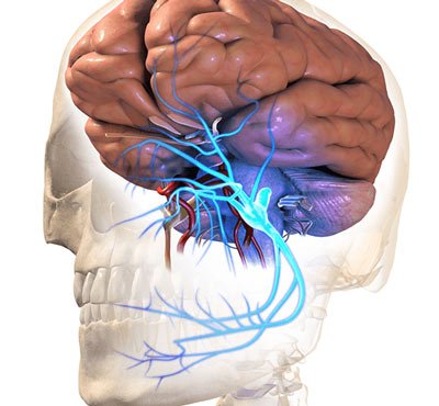 Tratamiento de las cefaleas cervicogénicas en Nueva York