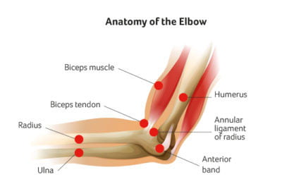 Elbow Pain Treatment in NYC