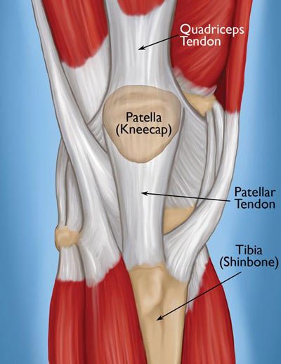 Tratamiento de la tendinitis de rodilla en NYC