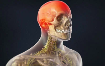 Occipital Neuralgia Treatment in NYC