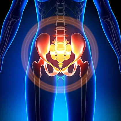 Pelvic Pain Treatment NYC