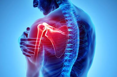 Shoulder Injuries Treatment in NYC