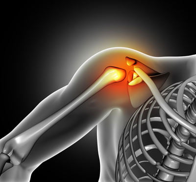 Shoulder Sprain, Strain Treatment in NYC