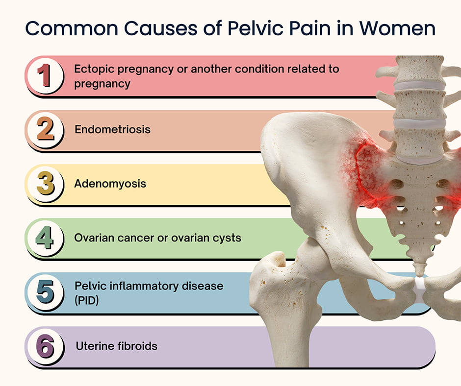 Causas del dolor pélvico