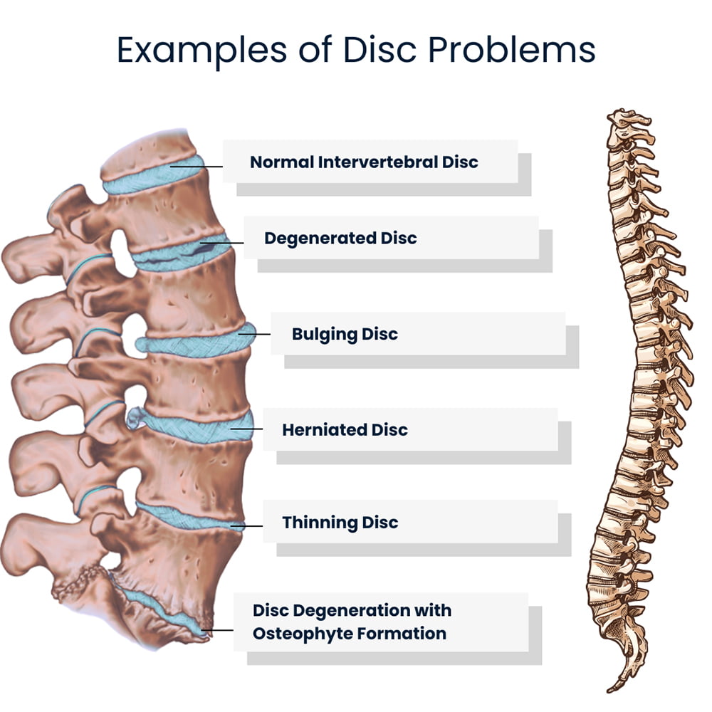 Back Pain Treatment in New York Back Pain Doctors NYC