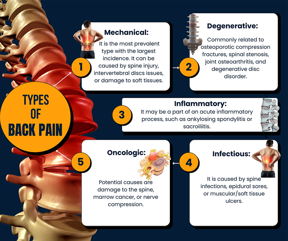Back Pain Treatment in New York Back Pain Doctors NYC