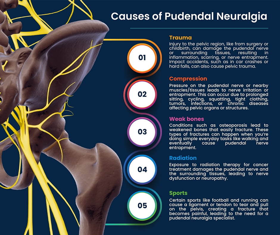 What Causes Pudendal Neuralgia?