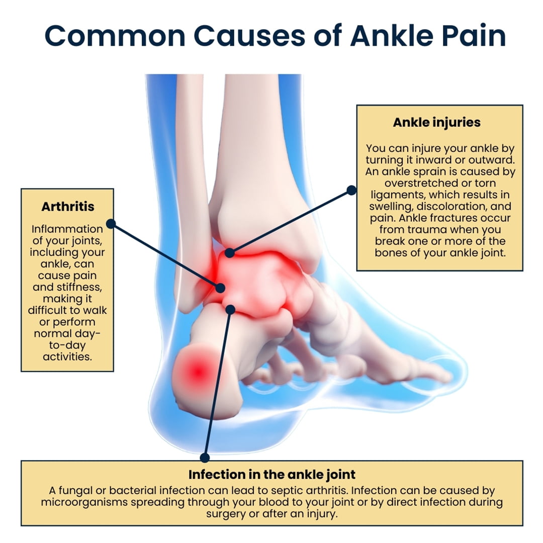 Common Causes of Ankle Pain