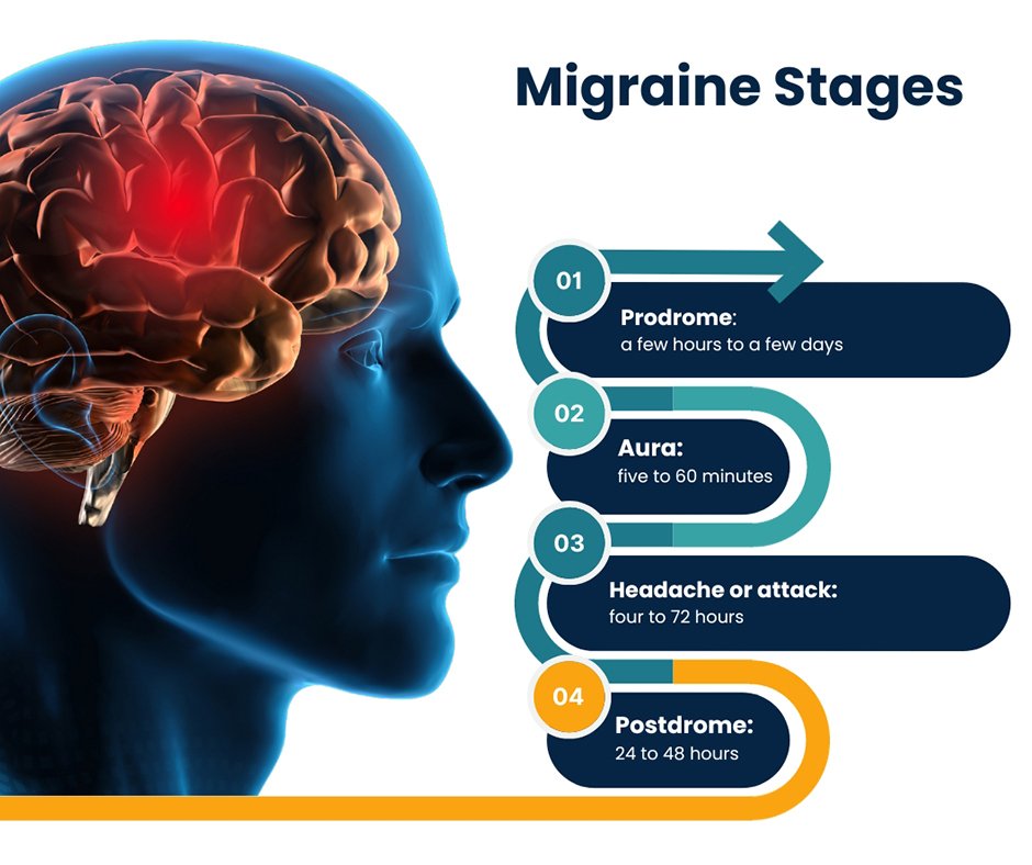 Migraine Stages