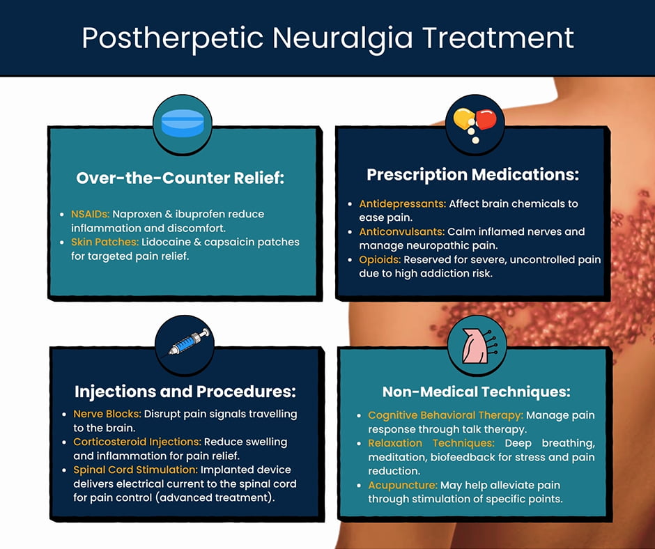 Postherpetic Neuralgia Treatment