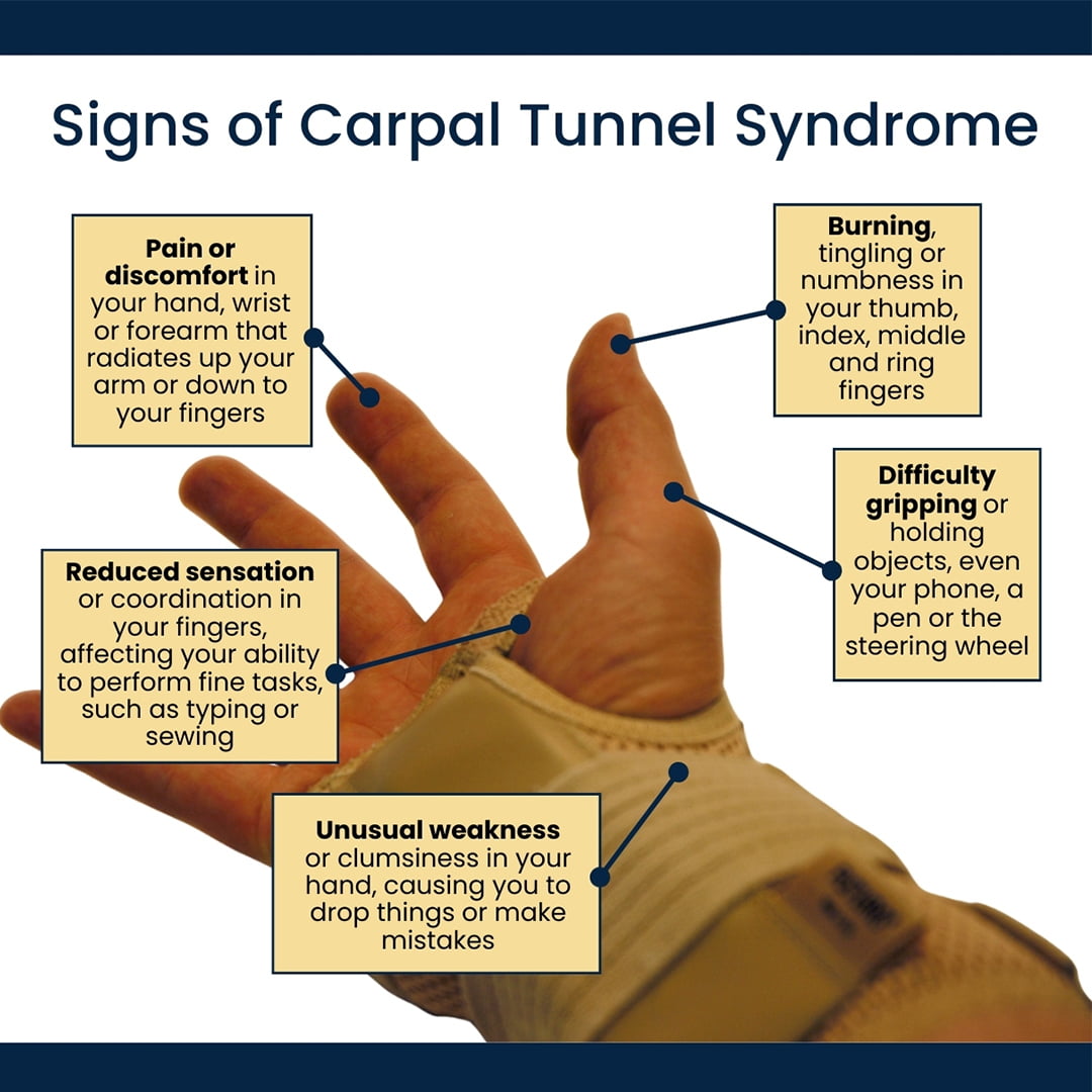 Síntomas del síndrome del túnel carpiano