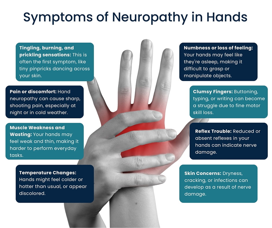 Symptoms of Neuropathy in Hands