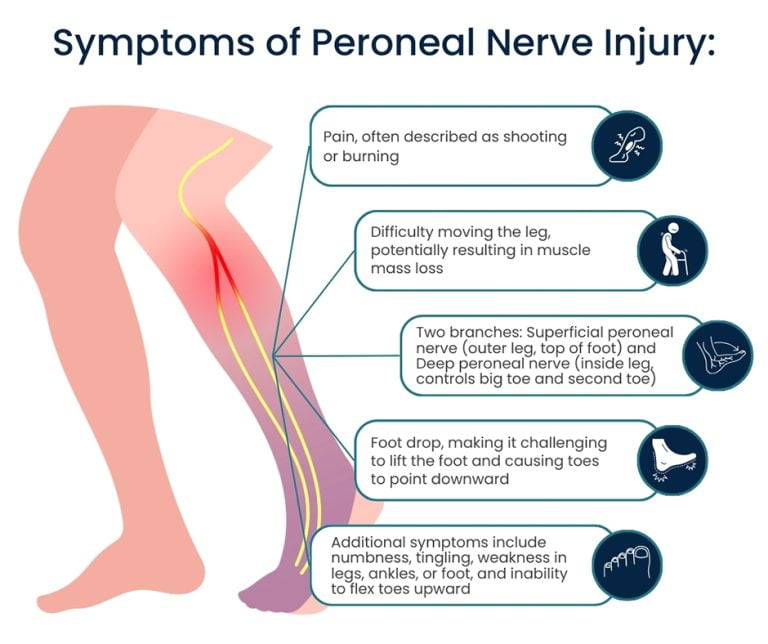 Peroneal Nerve Treatment in NYC Pain Management NYC Peroneal Nerve Treatment in NYC Pain Management NYC