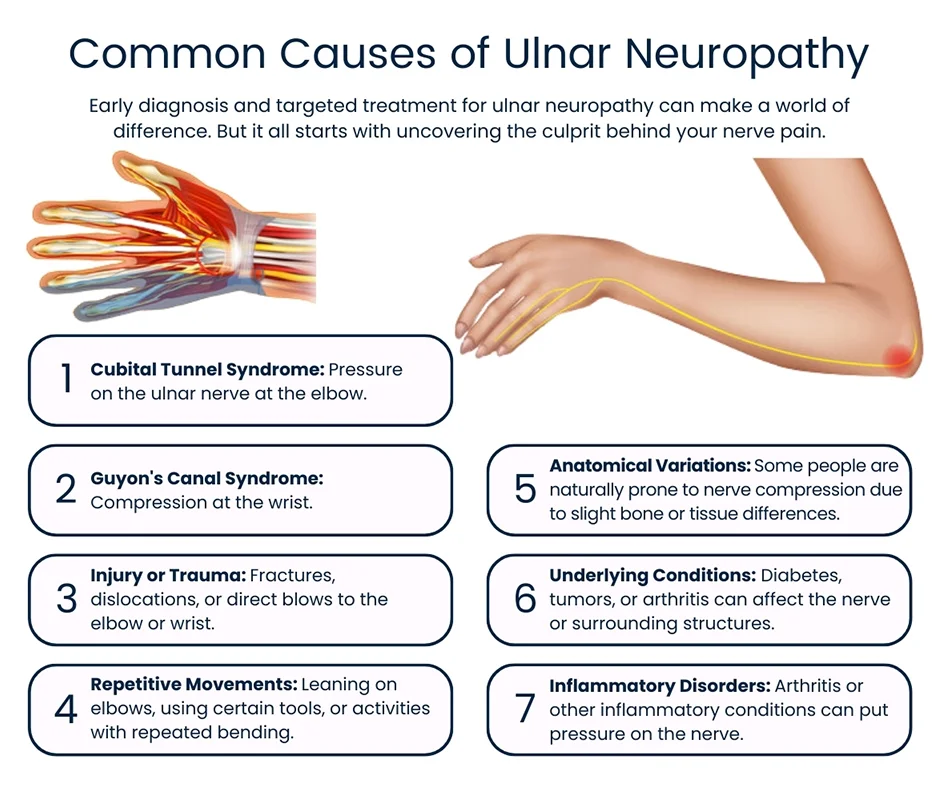 Causas de la neuropatía cubital