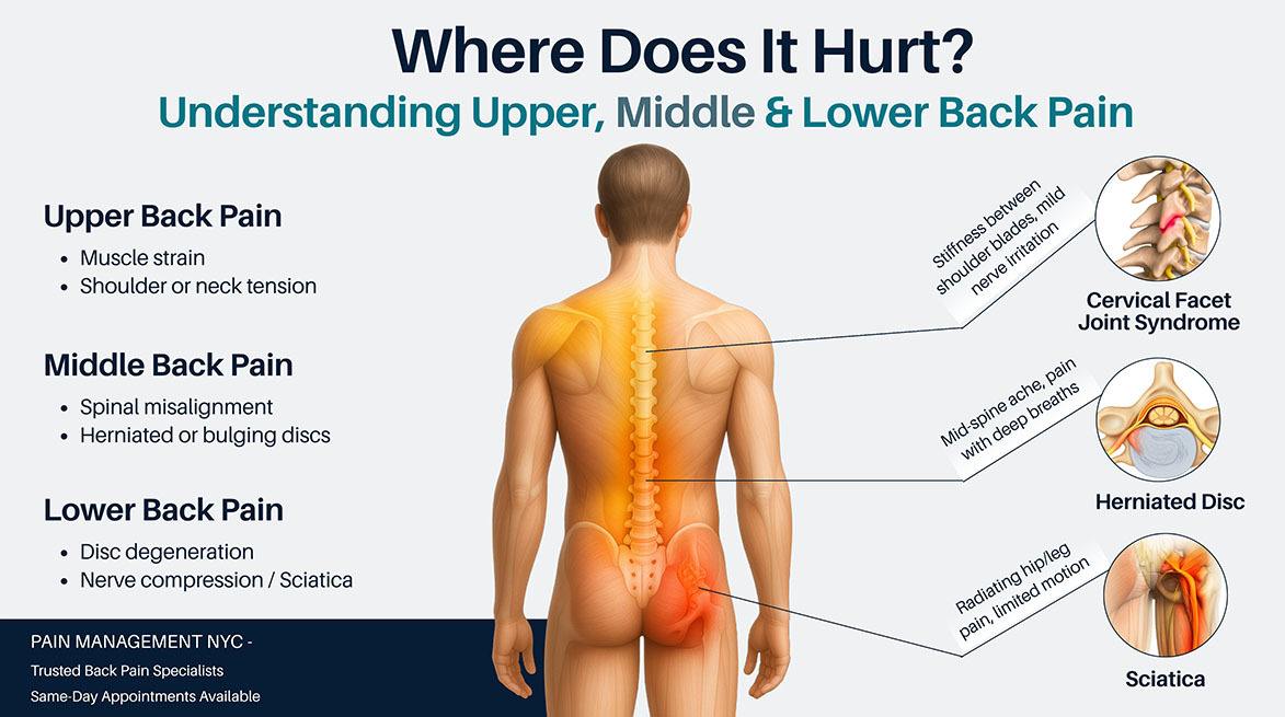 Upper, Middle and Lower Back Pain Infographic Pain Management NYC